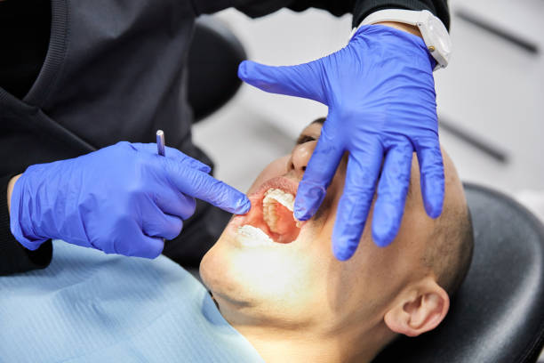 Trusted IN Emergency Dental Service Experts