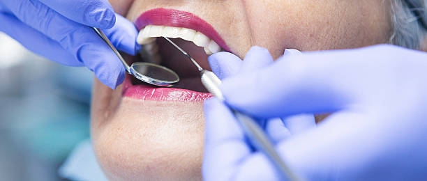 Best Broken or Chipped Tooth Repair in Oxford, IN